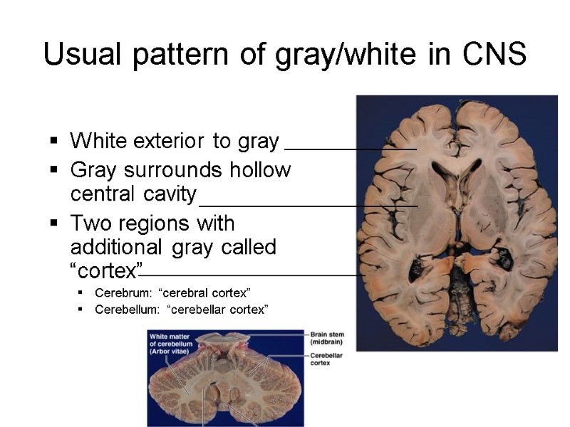 Usual pattern of gray/white in CNS White exterior to gray Gray surrounds hollow central